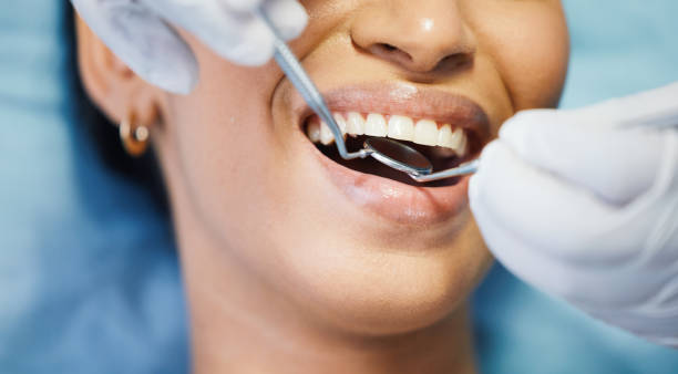 Best Emergency Dental Care for Abscessed Tooth in Washington, WV
